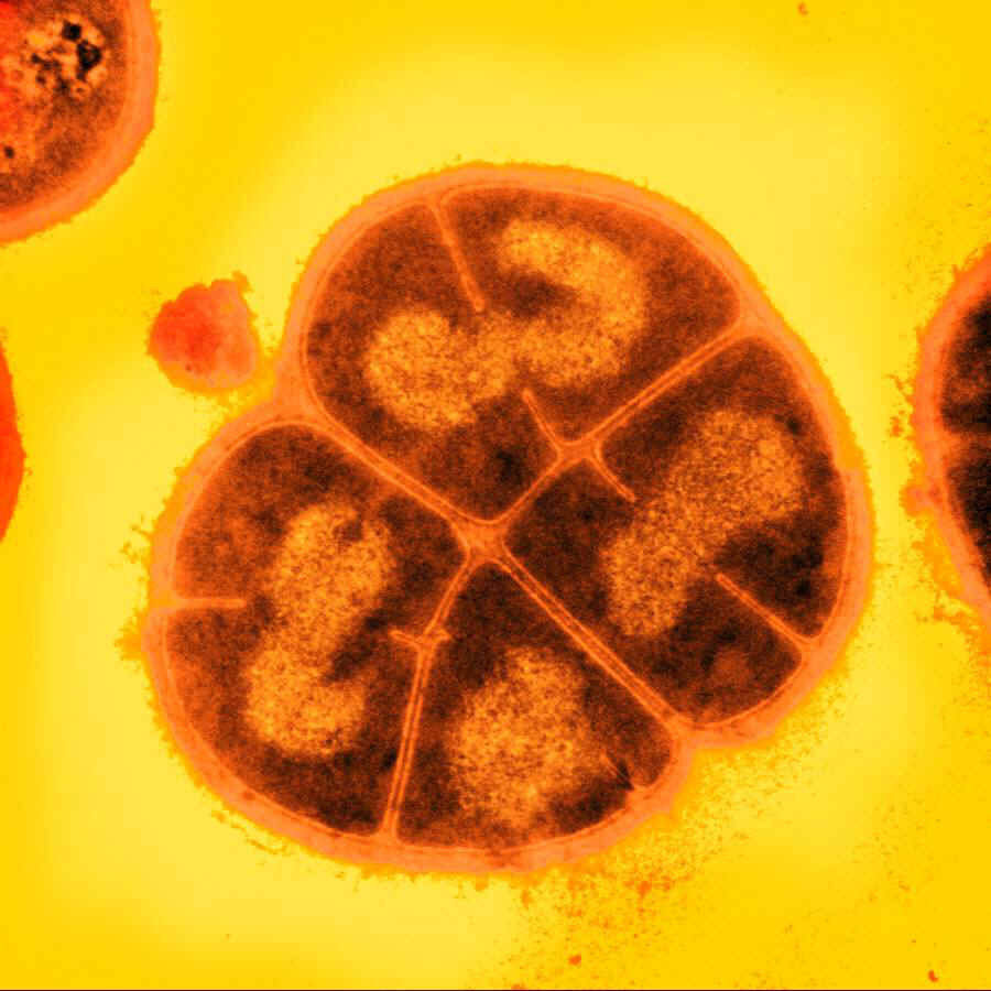 Deinococcus radiodurans: La bacteria astronauta