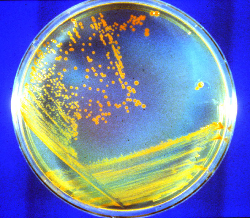 Deinococcus radiodurans: La bacteria astronauta