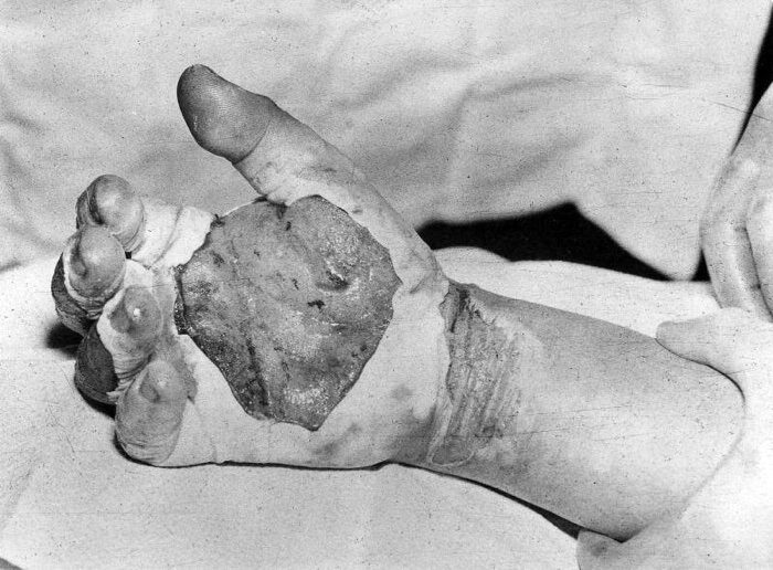 Los muertos del “Corazón del demonio”