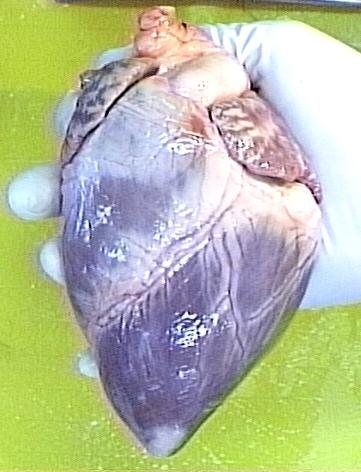 El corazon de un cerdo modificado puede implantarse en humanos.