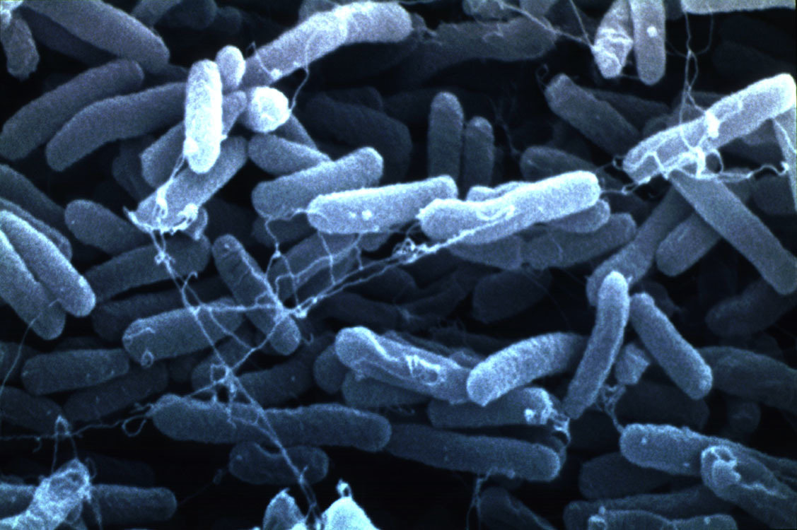 Coli sotwe. Бактерия Escherichia coli. Болезнетворные бактерии кишечная палочка. Бактериальные микробы кишечная палочка.