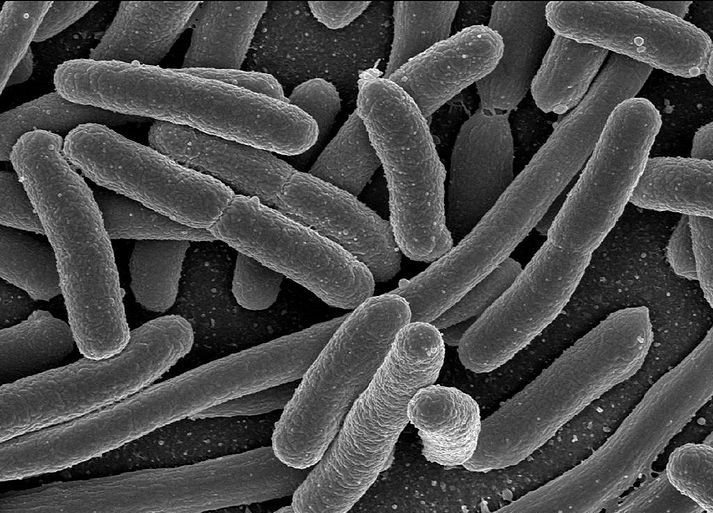 Esta es la E. Coli: La bacteria resucitada puede ser hasta 50 veces más pequeña