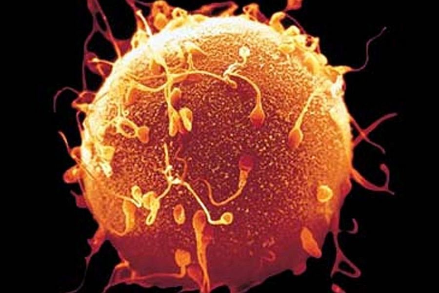 La posibilidad de obtener espermatozoides u óvulos a partir de células madre, es una esperanza de vida muy concreta