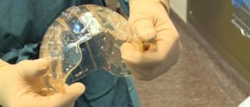 El implante colocado está creado con material plástico biocompatible