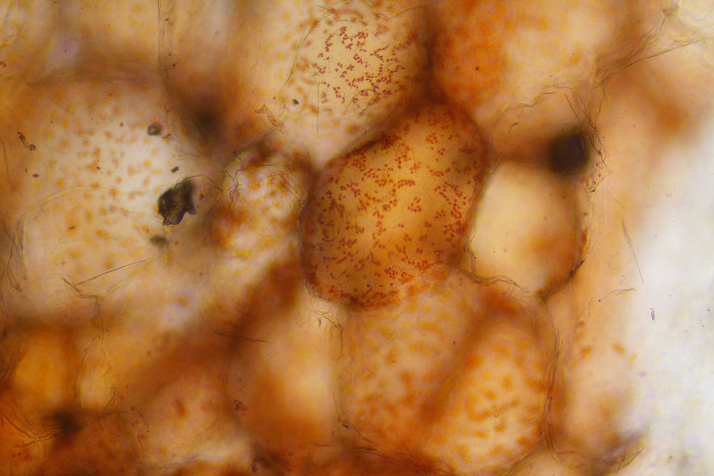 Клетка мякоти рябины. Бородавка под микроскопом. Папиллома под микроскопом.
